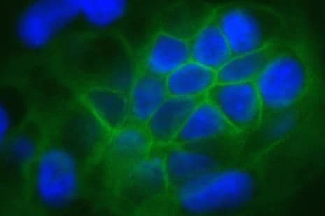 CLDN1 / Claudin 1 Antibody (C-Terminus, clone 2H10D10)