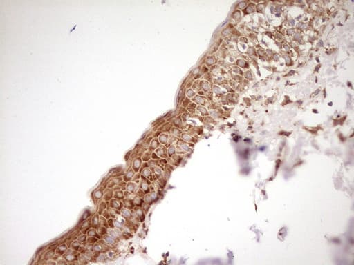 FARSB Antibody (clone OTI4B3)
