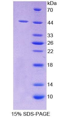 Human SCARA5 Protein (Recombinant His-T7)
