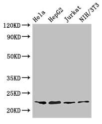 RPS5 / Ribosomal Protein S5 Antibody