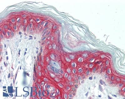 DSP / Desmoplakin Antibody (aa2609-2822)