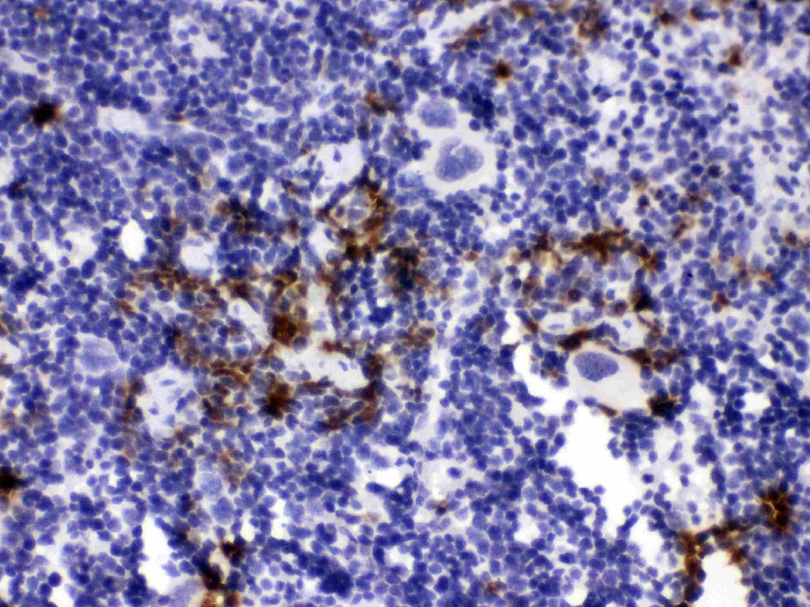 HNE / Neutrophil Elastase Antibody