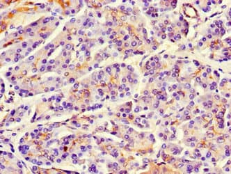 Polyclonal Rabbit anti-Human MAP10 / KIAA1383 Antibody