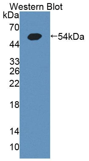 GCK / Glucokinase Antibody