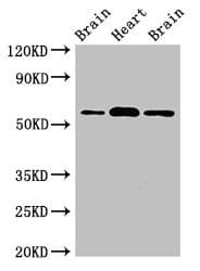 Polyclonal Rabbit anti-Human ATG14 Antibody (IHC, IF)