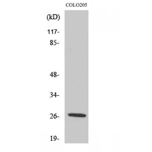 Polyclonal Rabbit anti-Human PRSS33 Antibody (30-110 aa, Internal, IHC, WB)