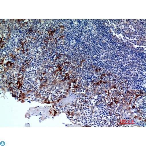 CMTM8 Antibody