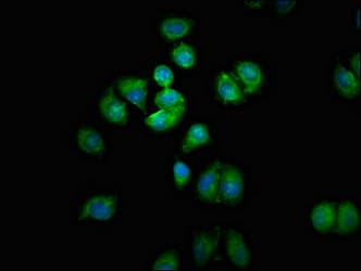 Polyclonal Rabbit anti-Human SMOX / PAO Antibody (IHC, IF)