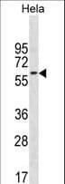 CD3EAP Antibody (aa54-81)