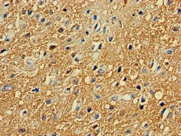Polyclonal Rabbit anti-Human PRKAR2A Antibody (IHC, IF, WB)