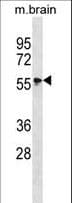 MAPK4 / ERK4 Antibody (aa67-94)