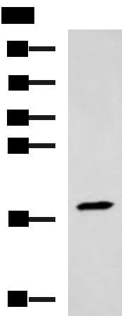 TNNC2 Antibody