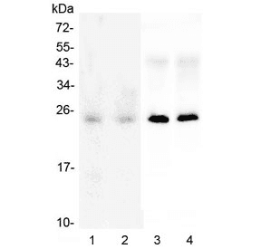 Polyclonal Rabbit anti-Human SNAP25 Antibody (IHC, WB)
