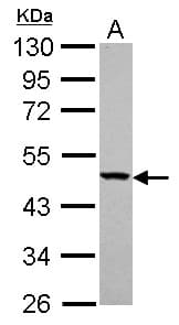 Polyclonal Rabbit anti-Human YARS2 Antibody (IHC, WB)