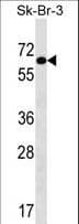 TRIP4 / ASC-1 Antibody (aa194-222)