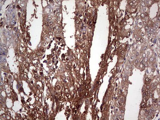 Monoclonal Mouse anti-Human LGALS3 / Galectin 3 Antibody (clone OTI15E4, IHC, WB)