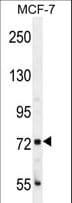 Polyclonal Rabbit anti-Human CTAGE4 Antibody (aa86-114, WB)