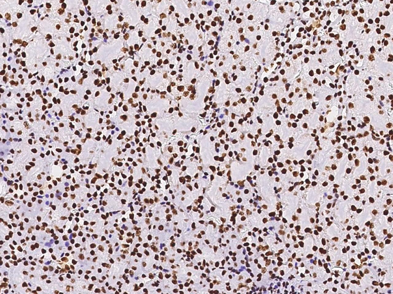 Polyclonal Rabbit anti-Human PAX2 Antibody (Preservative Free, IHC, IF, WB)