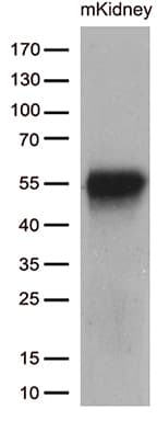 Monoclonal Mouse anti-Human BRUNOL6 / CELF6 Antibody (clone OTI2B8, WB)