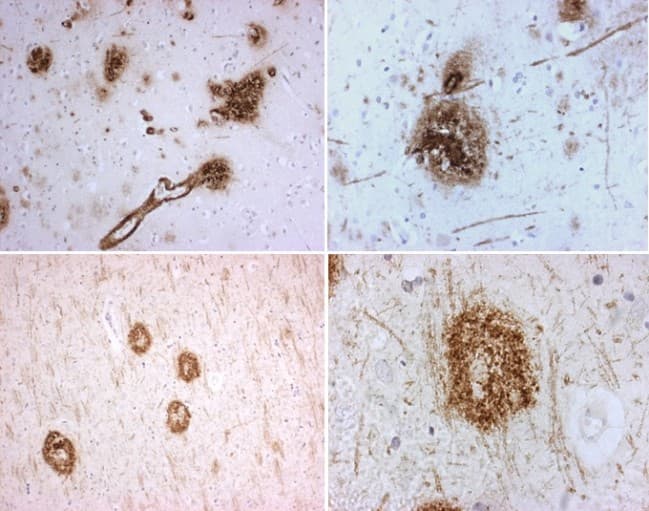 APP / Beta Amyloid Precursor Antibody
