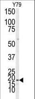 Polyclonal Rabbit anti-Human MAP1LC3B / LC3B Antibody (aa23-52, IHC, WB)