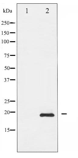 Polyclonal Rabbit anti-Human STMN1 / Stathmin / LAG Antibody (phospho-Ser37, IHC, WB)