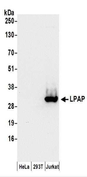 PTPRCAP / CD45 AP Antibody (aa156-206)