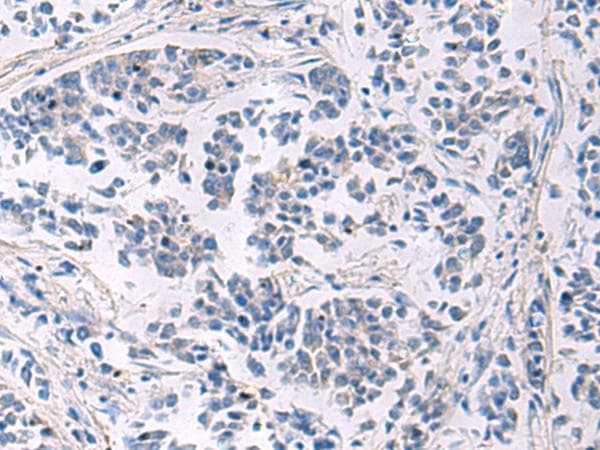 LAMP3 / CD208 Antibody