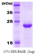 Human KIR2DL3 / CD152B2 Protein (Recombinant)