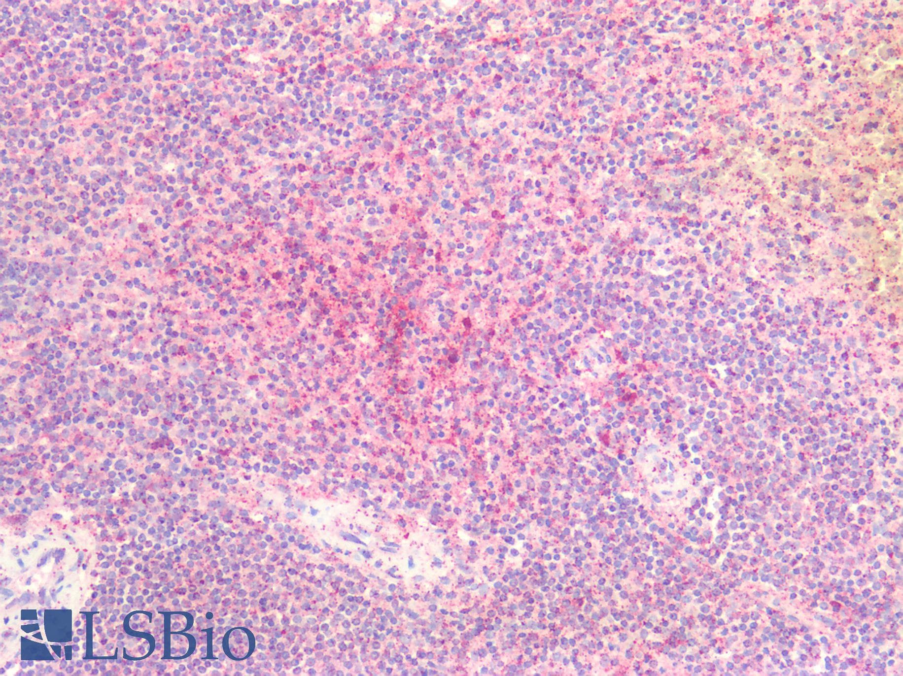 PathPlus™ HDAC4 Antibody