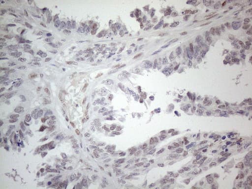 MMP2 Antibody (aa228-507, clone OTI4A11)