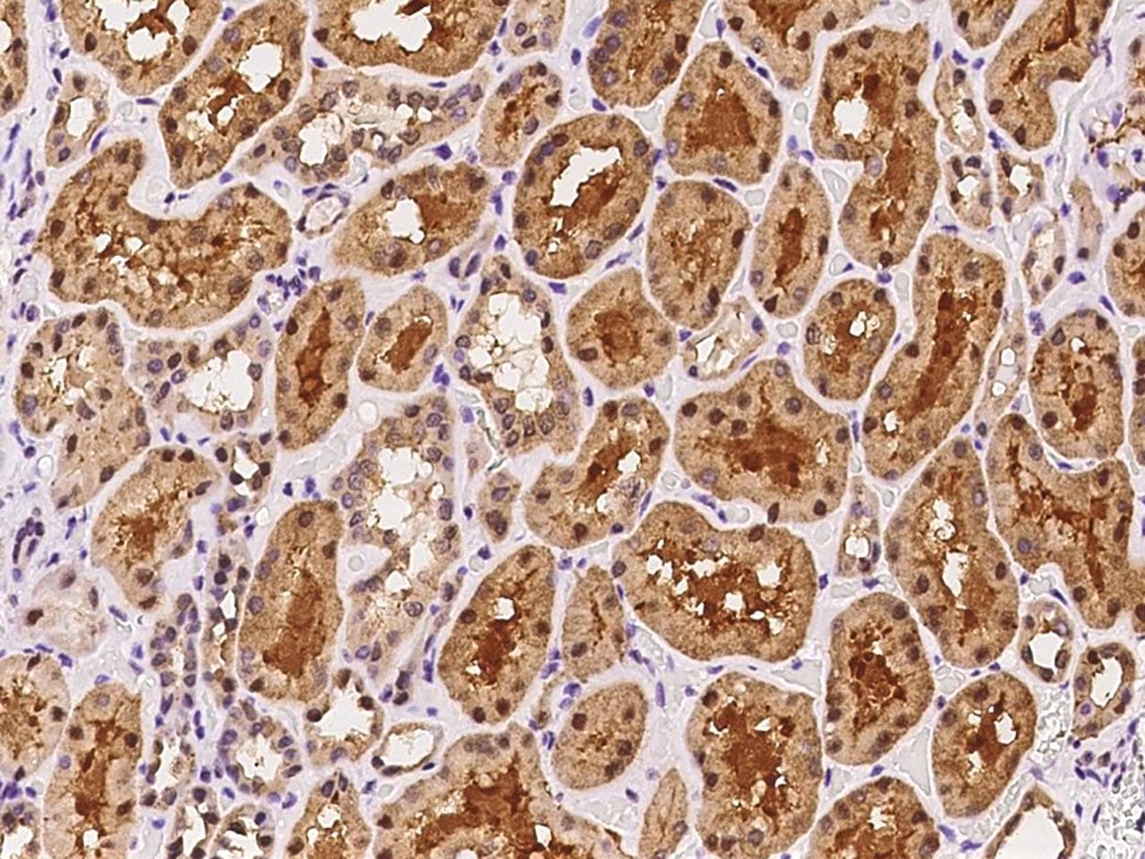 Polyclonal Rabbit anti-Human ISOC2 Antibody (IHC)