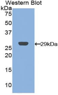 CRP / C-Reactive Protein Antibody (aa20-225)