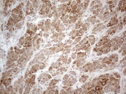 Monoclonal Mouse anti-Human PD-L2 / PDCD1LG2 / CD273 Antibody (clone OTI7B10, Carrier-free, IHC, WB)
