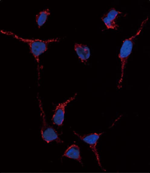 Polyclonal Rabbit anti-Human ALDH1A1 / ALDH1 Antibody (aa302-331, IHC, IF, WB)