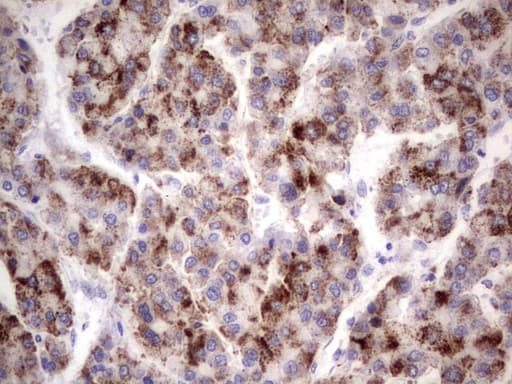 GBA / Glucosidase Beta Acid Antibody (aa40-315, clone OTI2C12)