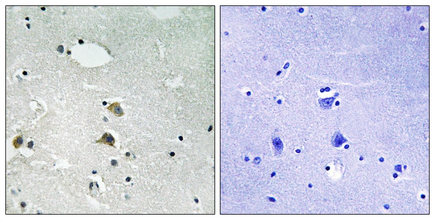 RPS6 / Ribosomal Protein S6 Antibody (Ab-235/236)