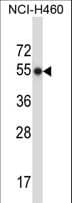 MMP8 Antibody (aa56-84)