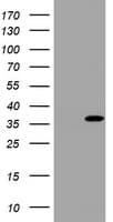 Monoclonal Mouse anti-Human TS / Thymidylate Synthase Antibody (clone OTI1E12, WB)
