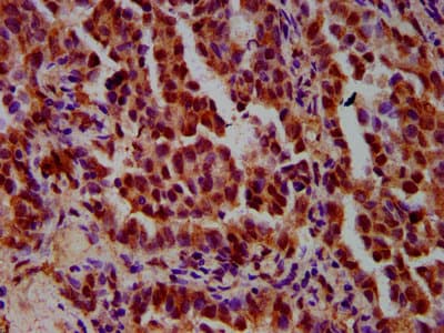 Polyclonal Rabbit anti-Human IMPDH1 Antibody (IHC, IF)