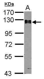 CAST / Calpastatin Antibody