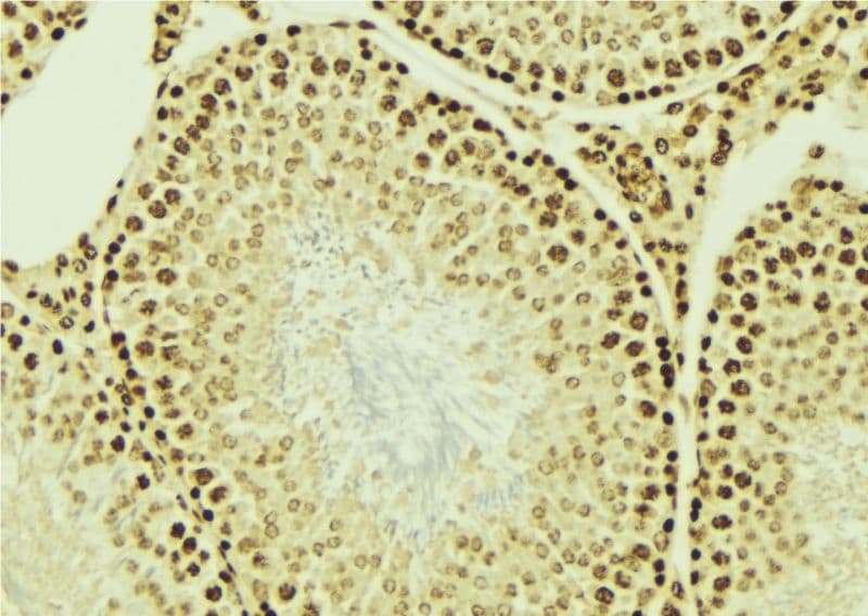 Polyclonal Rabbit anti-Human CRD-BP / ZBP1 / IGF2BP1 Antibody (IHC, WB)