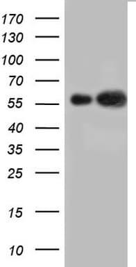 KRT7 / CK7 / Cytokeratin 7 Antibody (clone OTI2A2)