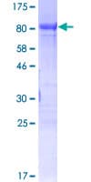 Human FOXC2 Protein (Recombinant GST)