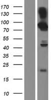 RAB11FIP4 / RAB11-FIP4 Protein (Over-Expression Lysate Myc-DDK (Flag))