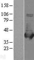 Human ALDOB Protein (Over-Expression Lysate Myc-DDK (Flag))