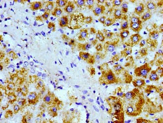 AGXT / SPT Antibody