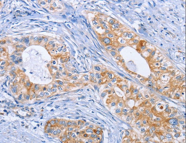 DOK4 Antibody