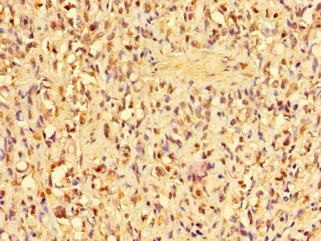Polyclonal Rabbit anti-Human ANP32D Antibody (IHC, IF)