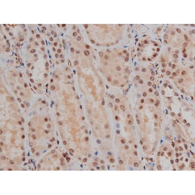 SP1 Antibody (phospho-Thr453)